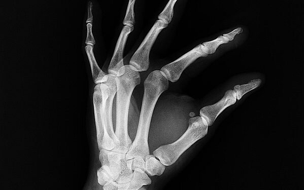 Finding Peace: How Medical Marijuana Can Help Ease Anxiety