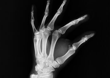 Unlocking the Power of THC and CBD: Finding the Perfect Ratio for Maximum Benefits