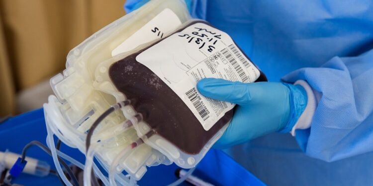 Finding Calm in the Chaos: How Cannabis Can Help Ease Anxiety